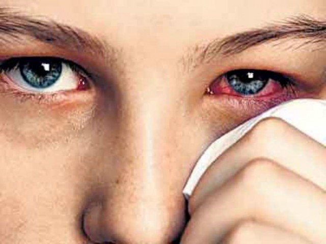 Cara Tradisional dalam Obati Sakit Mata