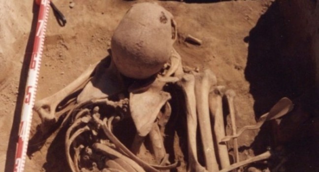 Ditemukan Kerangka Manusia Tertua, Kanker Ada Sejak 5000 Tahun Lalu?