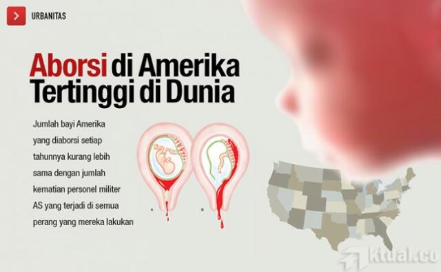 Fakta Mengejutkan, Aborsi di Amerika Tertinggi di Dunia dan Sulit Dihilangkan