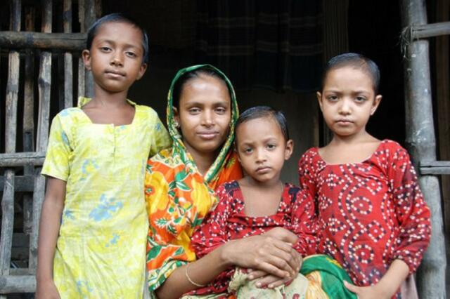 Pernikahan Usia Dini Timbulkan Struktur Otak Anak Kurang Sempurna?