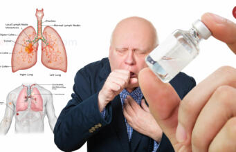 Obat 1 Dolar AS Ini Sembuhkan Kanker di Seluruh Dunia Penemuan obat Cimavax (aktual.com/nelson)