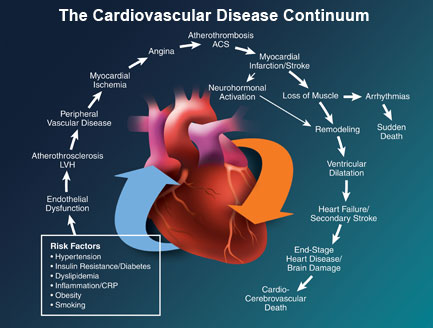 Ilustrasi Penyakit Kardiovaskuler