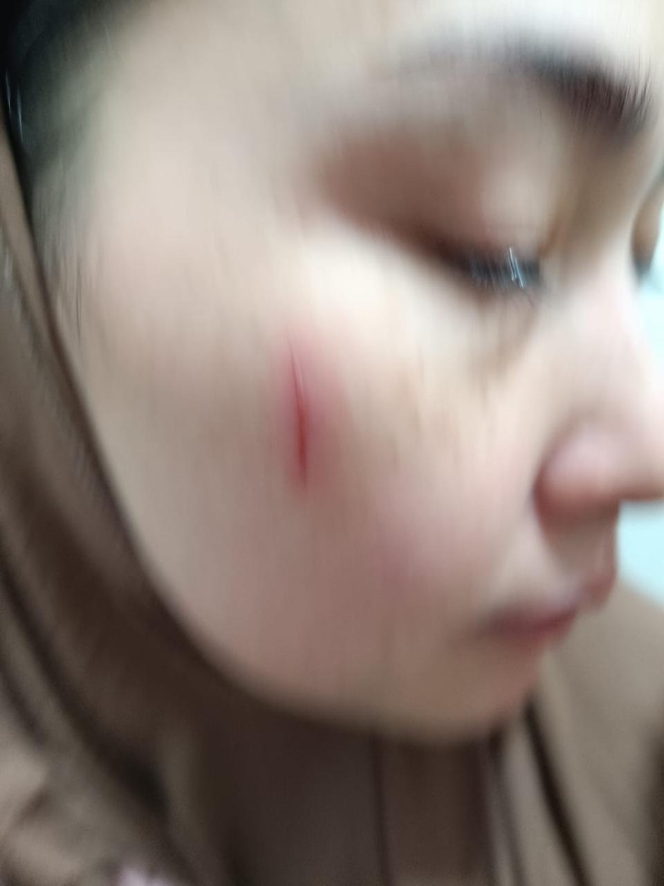 Stephanie Quenny Ferry, isti dari Paranormal Ferry Ferdyanto (FF) alias Ki Prana Lewu (KPL) mengalami luka di pipinya diduga disebabkan tindakan KDRT oleh suaminya 