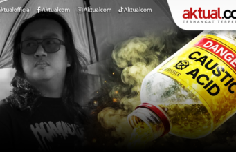 Andrie Yunus Jalani Operasi Terpadu untuk Selamatkan Mata Kanan Usai Diserang Air Keras