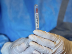 CDC: Virus Andes di Kapal Pesiar MV Hondius Bisa Menular Antar-Manusia, Namun Sangat Sulit Ilustrasi - Sampel Hantavirus di Ankara, Turki, pada Rabu (6/5/2026). ANTARA/Anadolu Agency/pri.