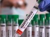 Waspada! Kemenkes Catat 23 Kasus Hantavirus, 3 Pasien Meninggal